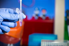 Close up of a hand holding a pipette and a plastic vial.